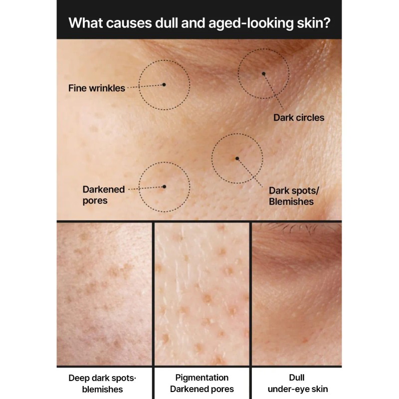 Pore Dark Spot Brightening Cream Non Irritating 35ml