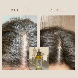 Hair Growth Oil – Stimulates Hair Growth, Strengthens Hair Follicles, Reduces Breakage, and Nourishes Scalp for Thicker, Fuller Hair