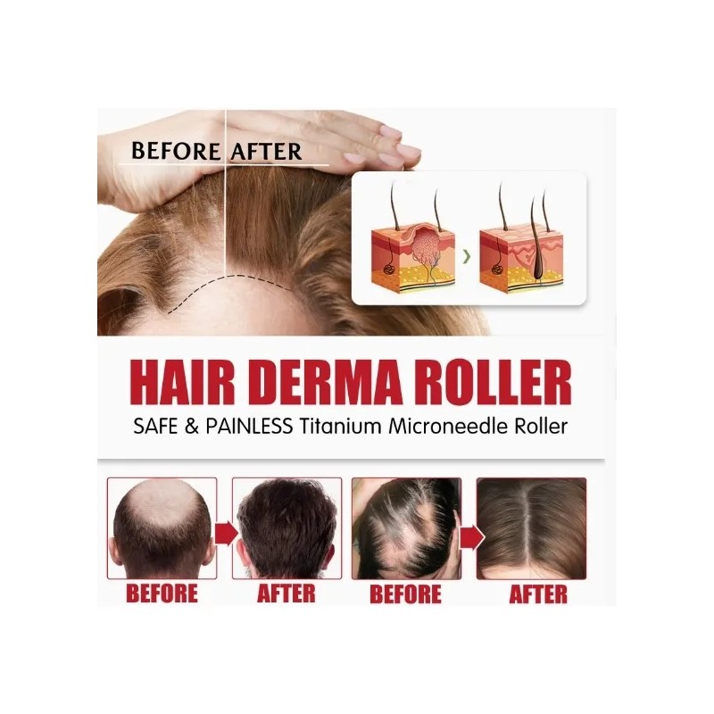 Dermaroller Barba Rodillo Facial Regenerador Aguja 0,5 Mm