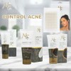 Kit Control Grasa & Acné Limpieza Profunda, 4pzs. Mc Life