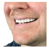 Generic,dientes postizos,blanqueador de dientes Paquete De 7 Pares Falsos Profesionales