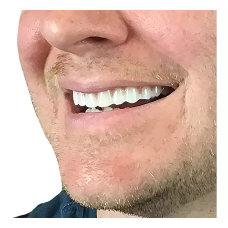 Generic,dientes postizos,blanqueador de dientes Paquete De 7 Pares Falsos Profesionales