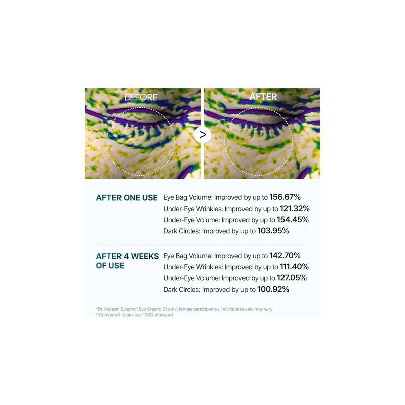 Dr. Melaxin - Eyephalt Crema Para Ojeras 10 ml