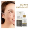 Serum Antiacn 30ml Mc Life Control Grasa Aclara Manchas Rostro