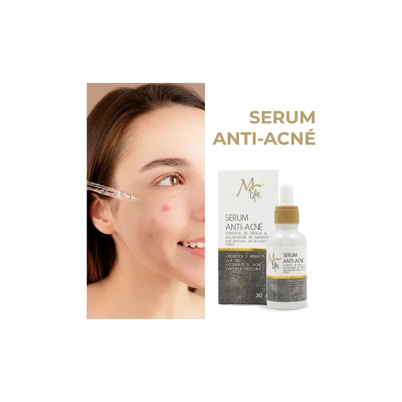 Serum Antiacn 30ml Mc Life Control Grasa Aclara Manchas Rostro
