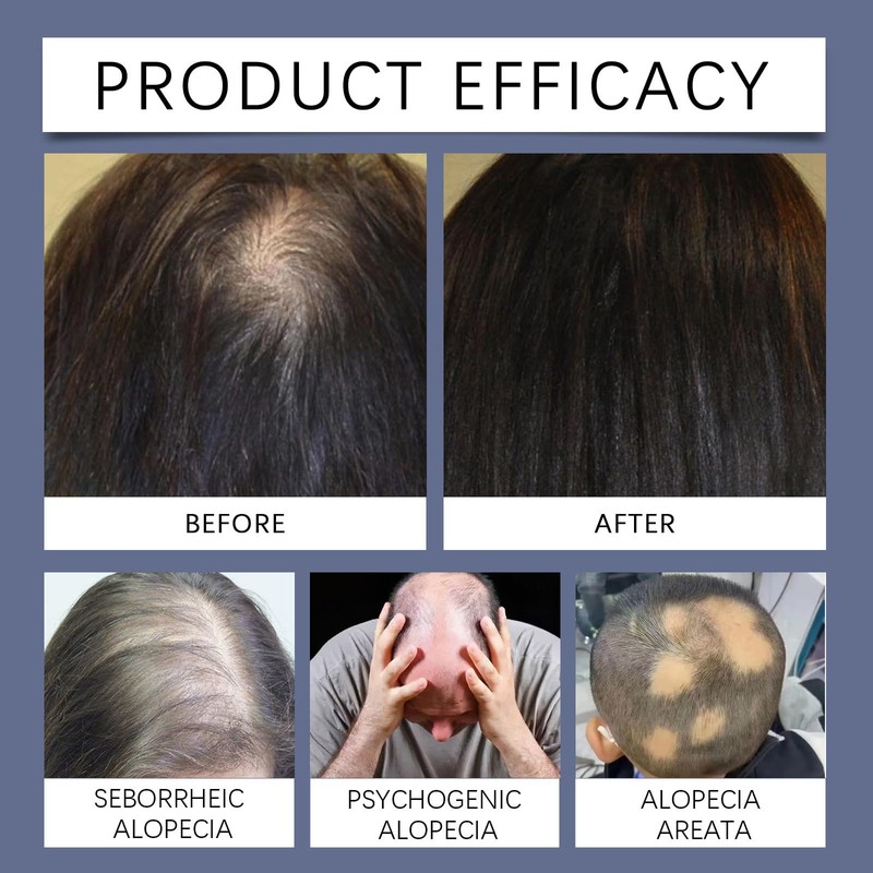 Rostblant Hair Conditioner 1