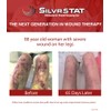 SilvrSTAT First Aid Kit Gel | 32 PPM Silver Healing