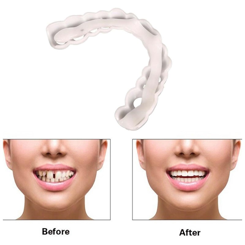 2 Pairs Beginner-Friendly Smile Tuning Kit, Tool-Free Shaping, Reusable Universal