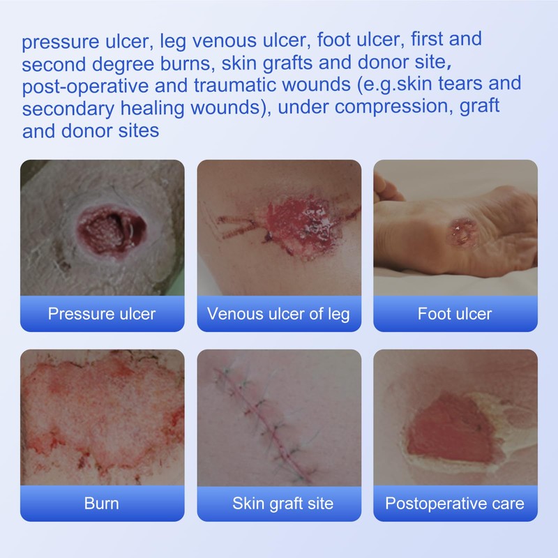 Niceful Silver Silicone Adhesive Foam Dressing Without Border, 4"×4" Ag