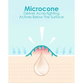 +1HEROLABS Microdart Acne Patch (54 Patches) - Hyaluronate Acid & Salicylic Acid Hydrocolloid Pimple Patch for Deep, Early and Hidden Blemishes (54 Count (Pack of 1))