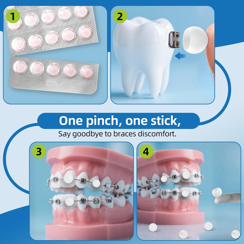 RioRand Orthodontic Wax for Braces Wax 120 Individual Hygienic Packaging