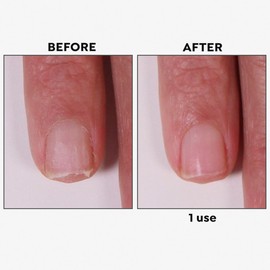 Spa-Rific Nano Laser Etched Glass Manicure Files, Professional Heavy Duty Nail Care Kit for Men, Women, and Adults - Single Blue