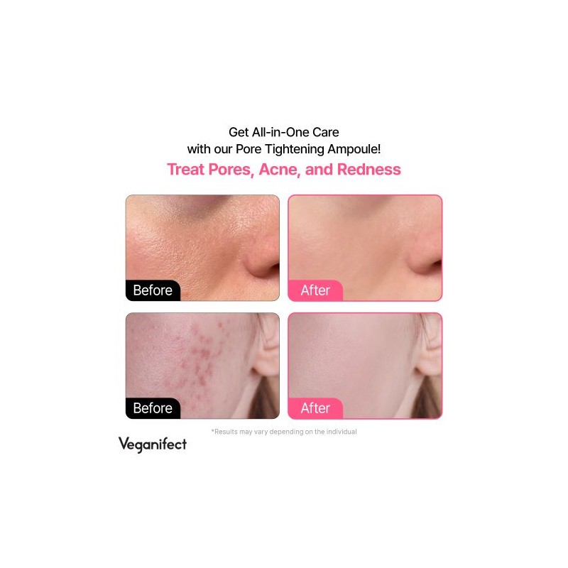 Veganifect [Veganifect]Lifting And Balancing Fig Chestnut Pore Tight Ampoule 50ml