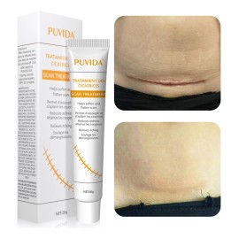 Crema Para Eliminar Cicatrices Gel Depara Reparar Cicatrices