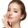 MUKBEC Acne Patch Pimple Patch,160 Pieces Acne Patches,Dressing Cover,Spot Stickers,Spot
