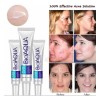 Tratamiento Para El Acné Bioaqua