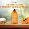 Healov Kojic Acid Soap for Hyperpigmentation – Skin Brightening Kojic