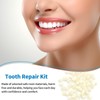 Dental Temporary Tooth Cap Crown Veneers Front Back Anterior and