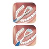 Gum GUM Dual Action Tongue Cleaner, 1 Single Tongue Cleaners,