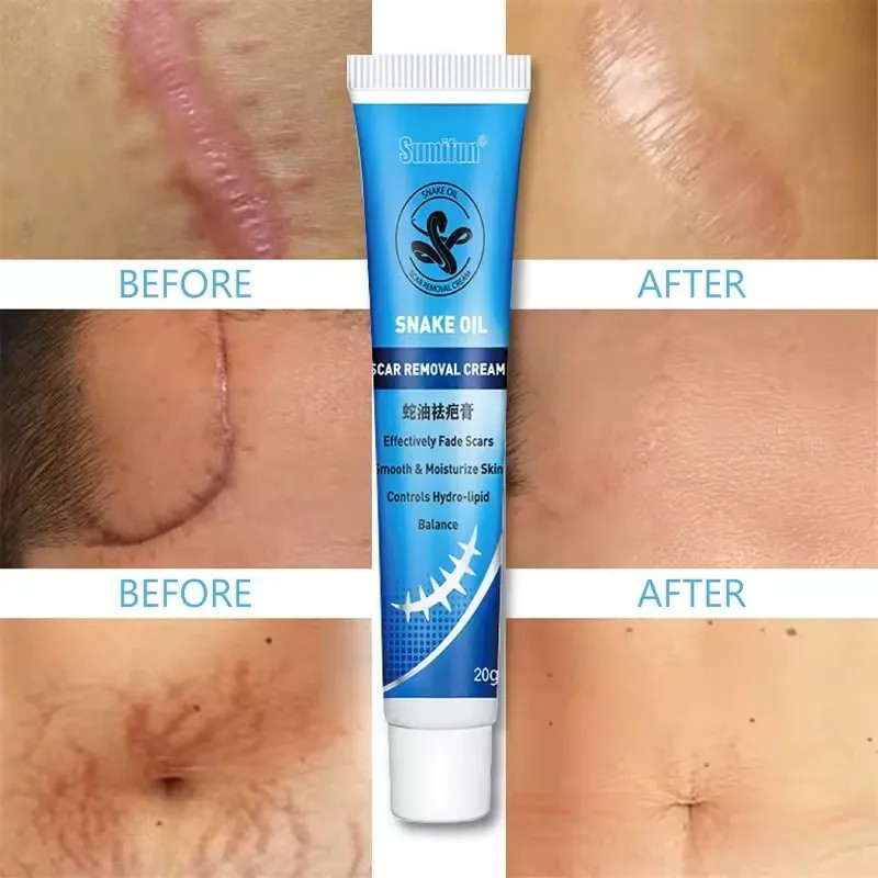 2 Pomadas Quirúrgica Elimina Cicatrices Sumifun