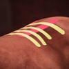 Tmax Canine & Equine Kinesiology Tape | Veterinary Medical Tape