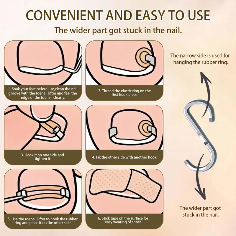 Ingrown Toenails Set, Nail Clip, Toenails, Pack of 180
