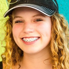 Healifty 30 Unids Base Redonda Botón Lingual Dental Metal Dentista Ortodoncia Hebillas Dentales Materiales Dentista Ortodoncista (Plata)