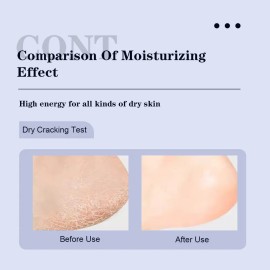 Crema Para Pies Intensiva Con Ácido Salicílico Como Eliminad