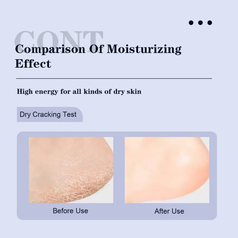 Crema Para Pies Intensiva Con Ácido Salicílico Como Eliminad