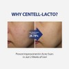 SUNGBOON EDITOR [SUNGBOON EDITOR]Centell Lacto AC Less Skin Barrier Essence