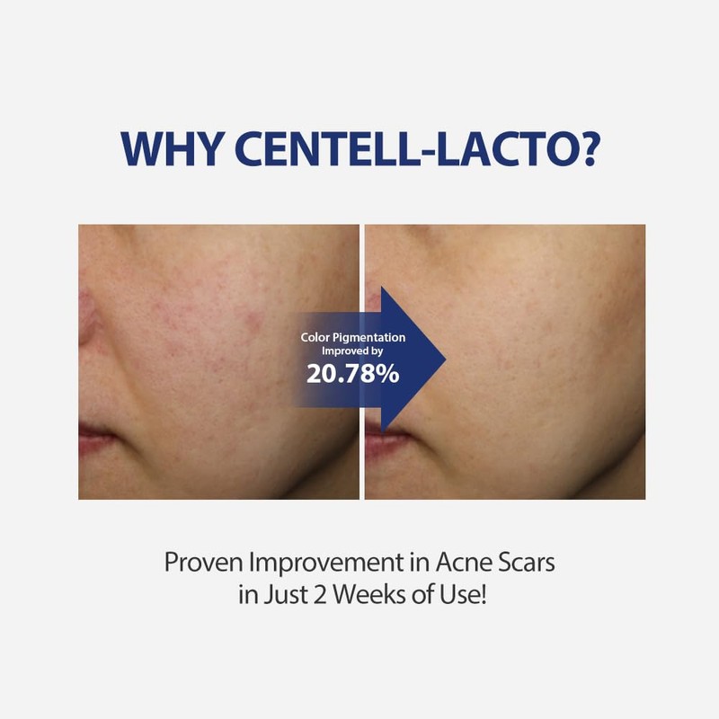 SUNGBOON EDITOR [SUNGBOON EDITOR]Centell Lacto AC Less Skin Barrier Essence