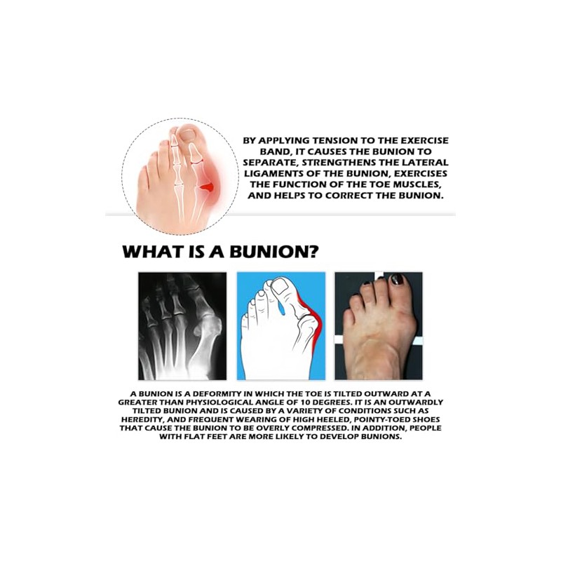 1 Piece Big Toe Training Band Hallux Valgus Band Corrector
