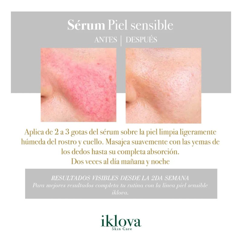 Sérum Iklova Niacinamida 30 Ml Piel Sensible Azuleno