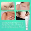 Wewell Crema de silicona para cicatrices y queloides – elimina