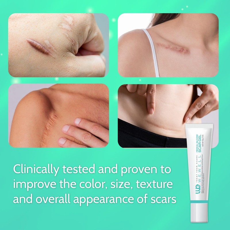 Wewell Crema de silicona para cicatrices y queloides – elimina