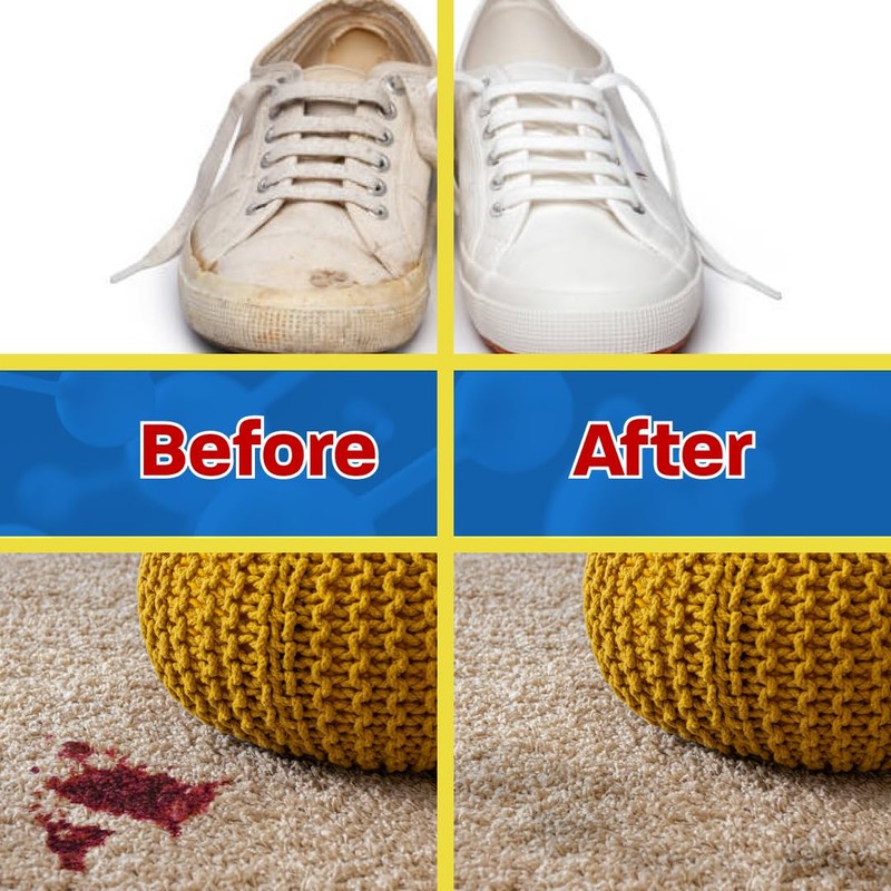 Stingray Spot Remover Combo Kit – Eco-Friendly, Advanced Multi-Surface Stain
