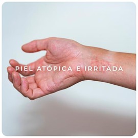 DERMAN Cuidados Intensivos Atopi Calm, Crema Corporal Dermatológica 300 g para Piel Atópica, Muy Sensible y con Tendencia a Irritación o Enrojecimiento, con Urea-D 5 %, Avena Coloidal y Manteca de Karité