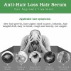 El Crecimiento Del Cabello Suero, Pérdida De Cabello Y AdeLG