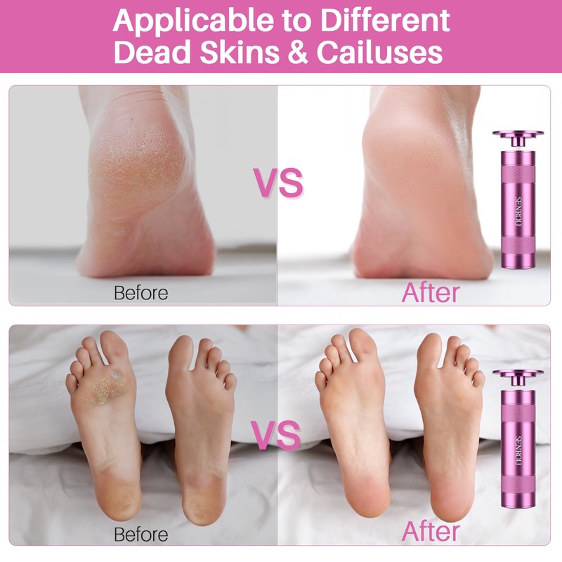 Electric Foot Callus Remover, 2-in-1 Electric Foot Filer/Nail Filer, Callus