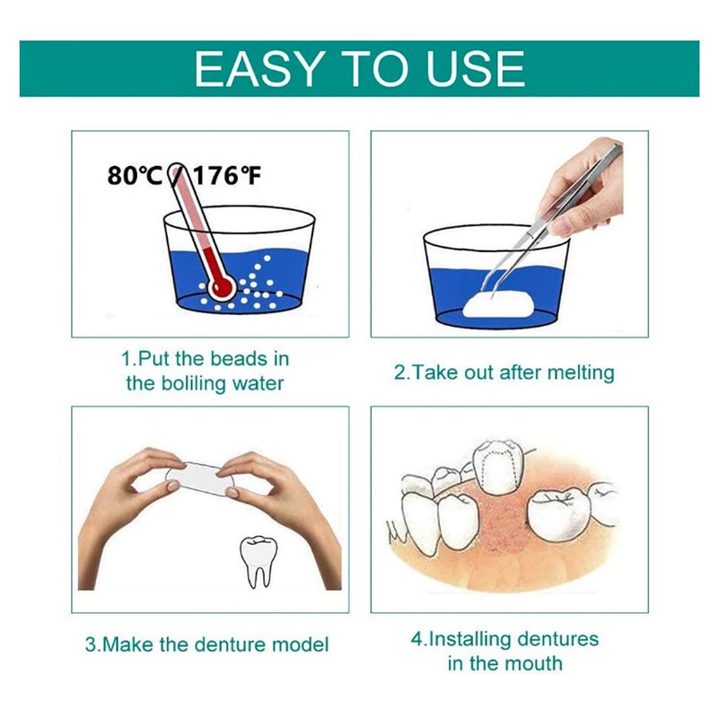 QincLing 2 Pairs of False Teeth Veneers, Temporary Teeth, Artificial