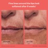 Peach Lily Crema Hidratante Reafirmante Peptide Pro Antiarrugas Última Generación