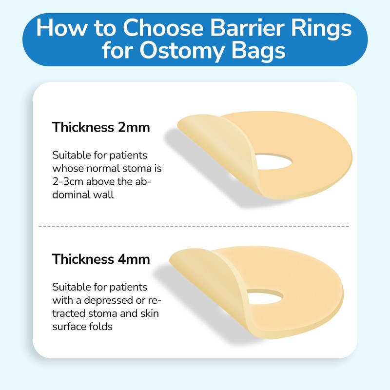 Heagimed 10Pcs 2mm Moldable Ostomy Rings, Hydrocolloid Stoma Barrier Rings