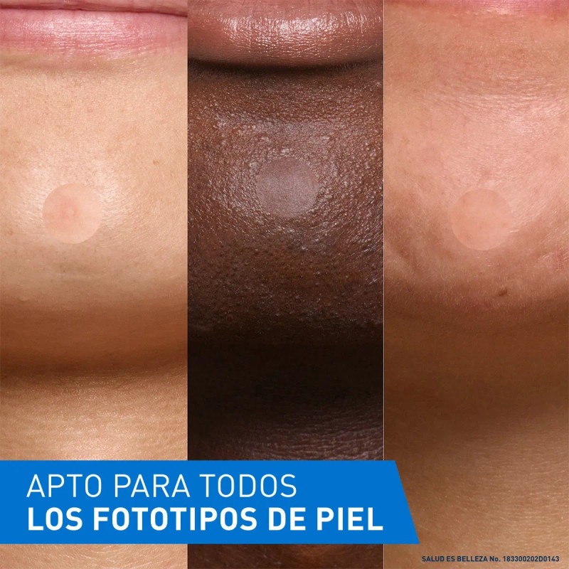 Cerave Parches Control Imperfeccion 22p Piel Tendencia Acné