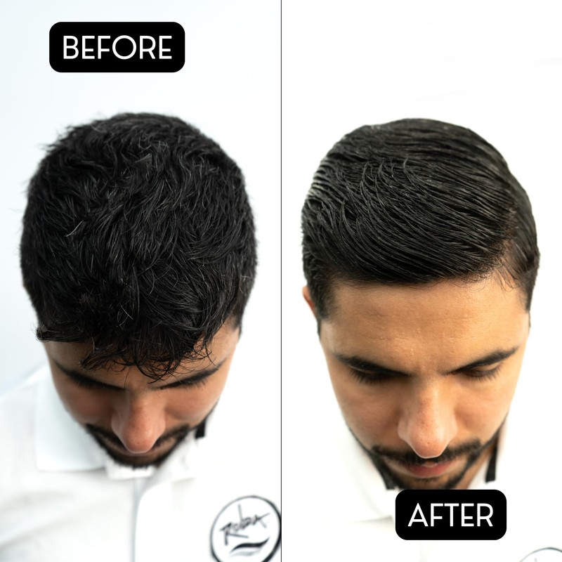 Rolda Power Styling Gel Hair Loss Control 17.6oz