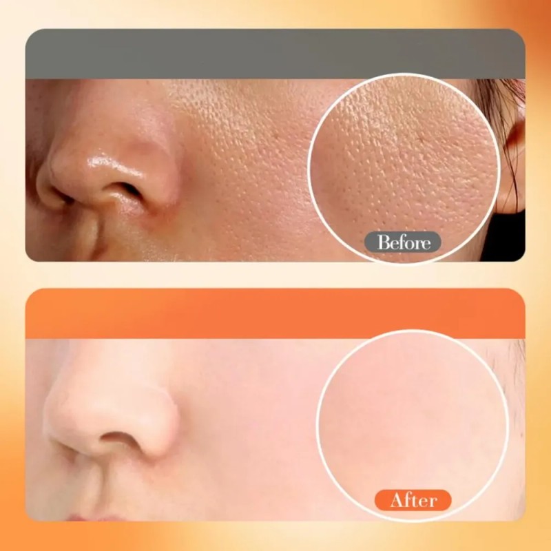Sérum De Vitamina C: Cuidado Facial Hidratante: Ilumina La P
