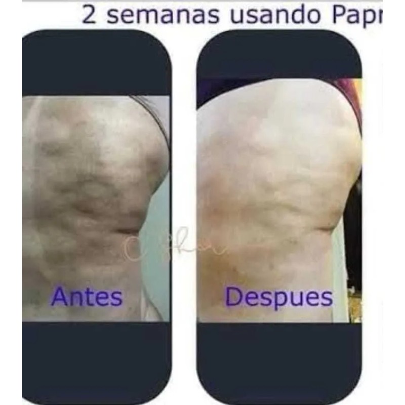Pack 2 Geles Paprika Estrias, Flacidez, Celulitis Farmasi