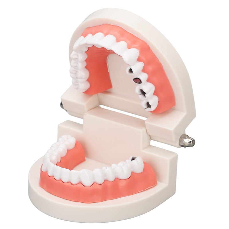 Dental Disease Caries Teeth Model Resin Simulation Teaching Prop Dental