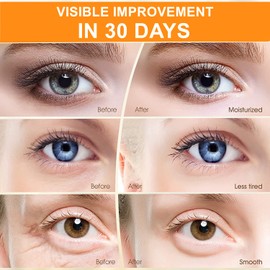 (30 Pairs) Eye Mask, Crystal 24K Gold Powder Gel Collagen Premium Eye Treatment Mask, Anti-Ageing & Wrinkles, Moisturising, Puffy Eyes