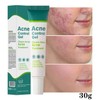 블랙헤드 모공수축 기미개선 아크네 크림 살리실산 아젤라익산 Blackhead Pore Tightening