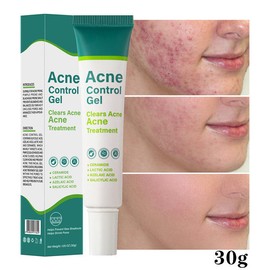 블랙헤드 모공수축 기미개선 아크네 크림 살리실산 아젤라익산 Blackhead Pore Tightening Dark Spot Improvement Acne Cream Salicylic Acid Azelaic Acid